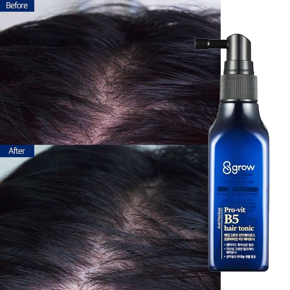 8grow Anti Hairloss Pro-Vit B5 Hair Tonic